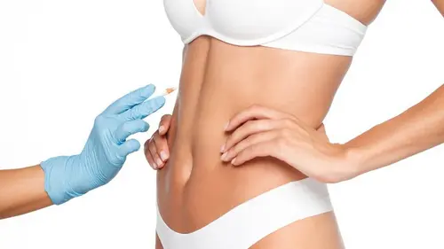 plastia tras ahuecamiento